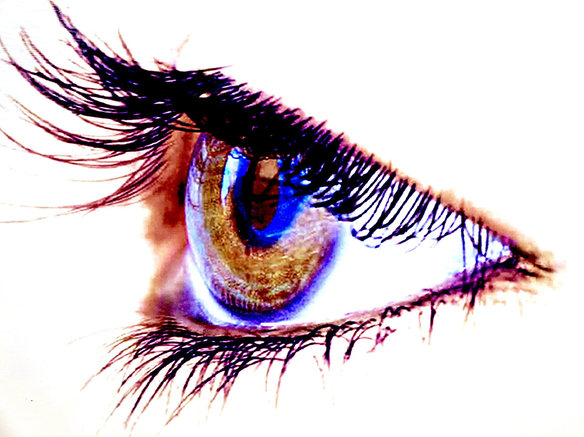 Blefaritis ili upala očnih vjeđa - kako liječiti upalu?