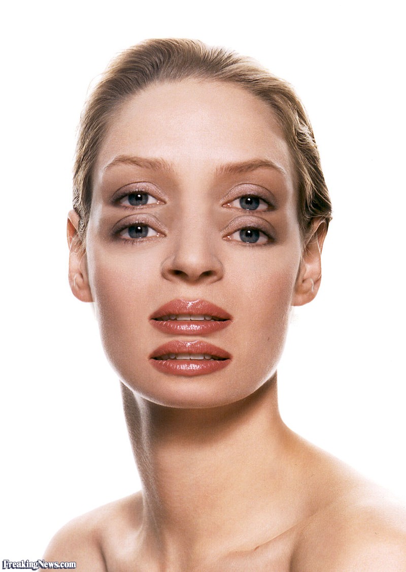 Miastenija gravis - kako utječe na oči?