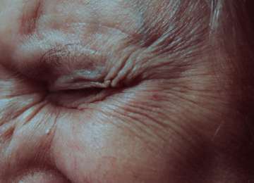 Bol u oku – što je uzrokuje i koji su simptomi?