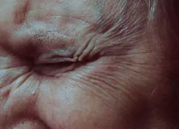 10 očnih poremećaja na koje trebate obratiti pozornost