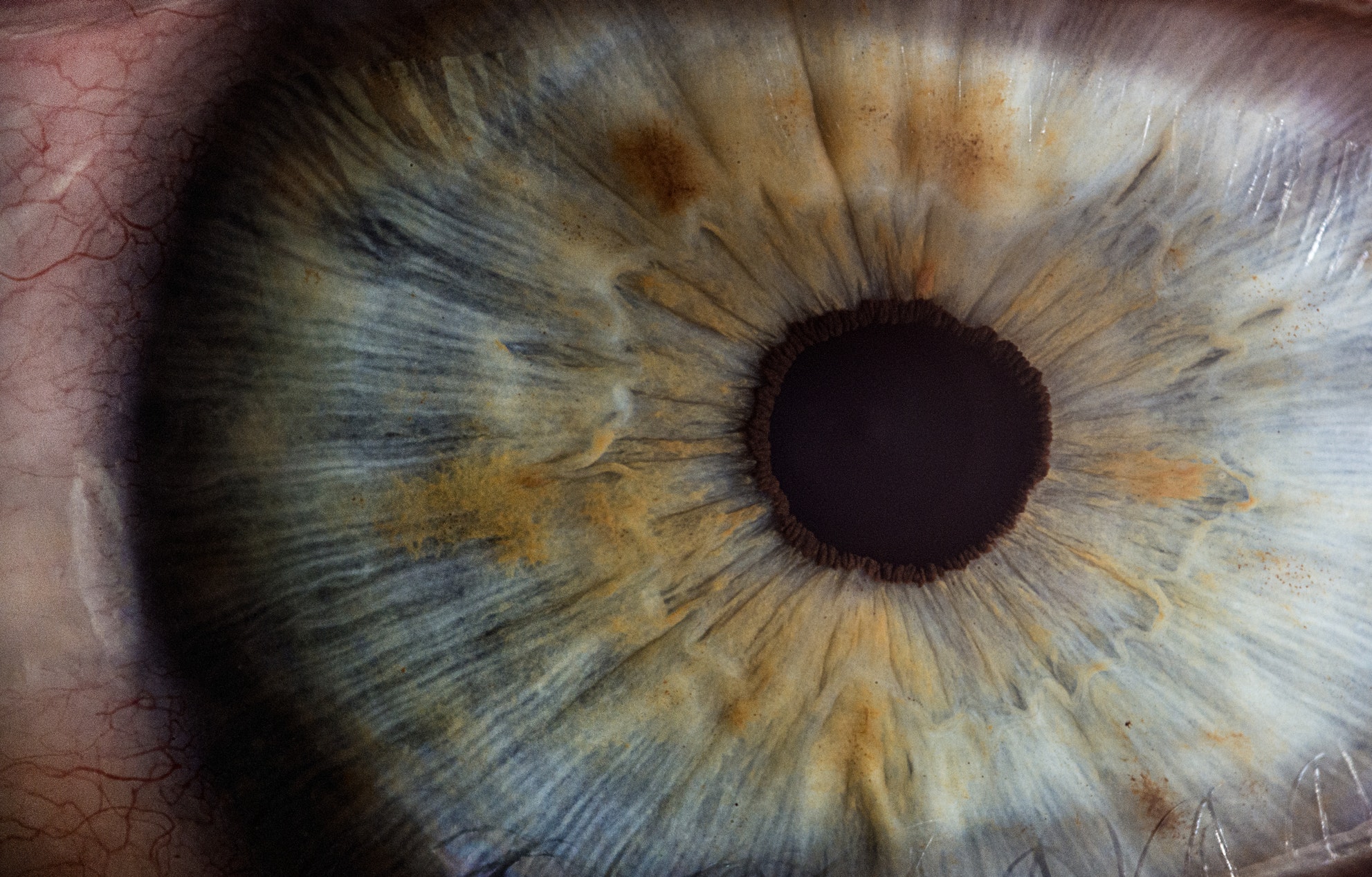 Heterokromija: zašto oči mijenjaju boju?