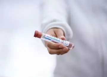Serološkim testiranjem saznajte jeste li se susreli s koronavirusom!