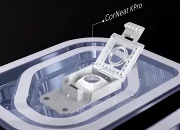 Prva uspješna implantacija umjetne rožnice