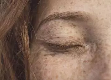 Tamni kapci na očima - kako ih se riješiti i izgledati blistavo?