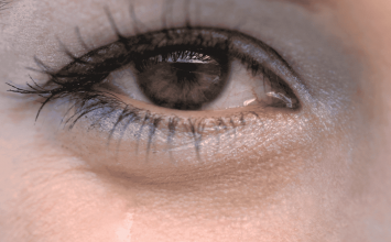 Suzne oči: uzroci, prirodni lijekovi i kada posjetiti liječnika