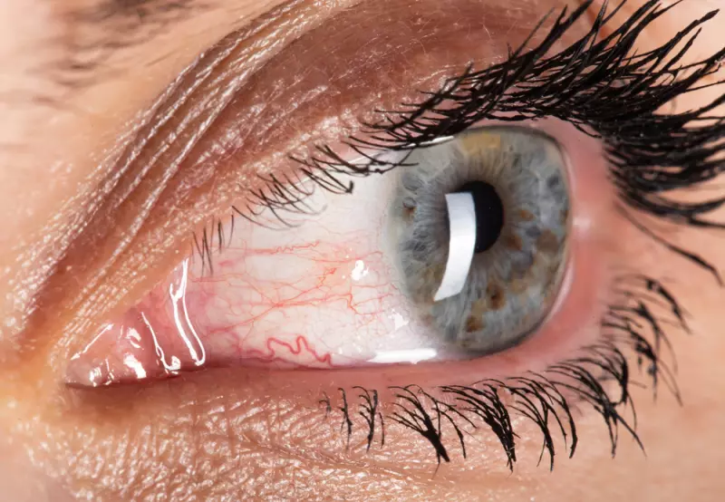 Konjuktivitis - vrste, uzroci, simptomi i lijeenje | Dioptrija.hr