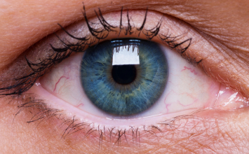 Zašto vam smeta tuđi blic, jako svjetlo i otvorene rolete više nego prije?