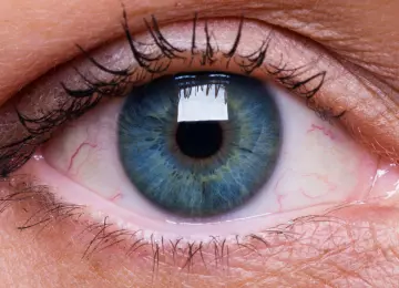 Zašto vam smeta tuđi blic, jako svjetlo i otvorene rolete više nego prije?