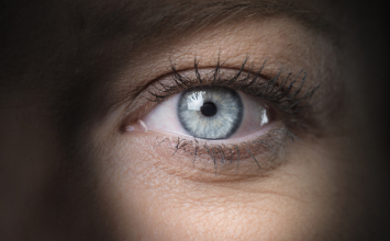 Neuritis vidnog živca - optički neuritis: uzroci i simptomi
