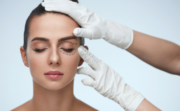 Blefaroplastika: kada korekcija kapaka nije samo pitanje izgleda?