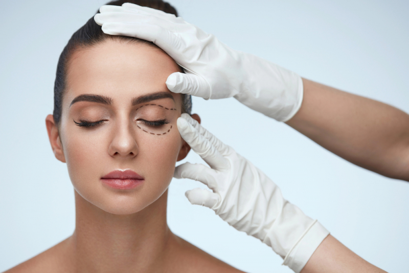 Blefaroplastika
