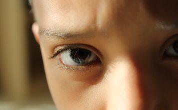 Kako prepoznati visoki očni tlak? | aeschanguinola.com