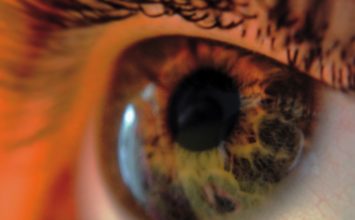 Očni tlak – prirodno liječenje, mjerenje i uzroci