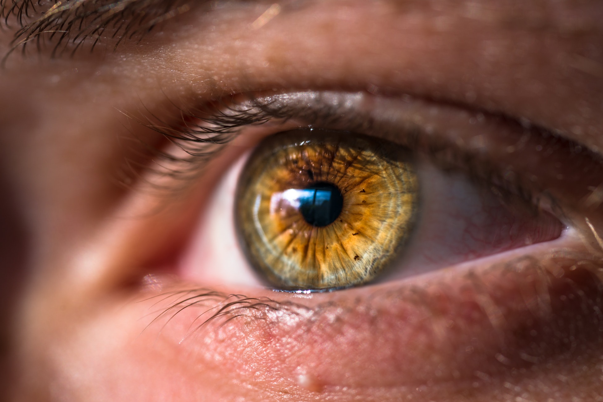 Imam povišen očni tlak, da li bolujem od glaukoma? | spo-ovnilogia.com